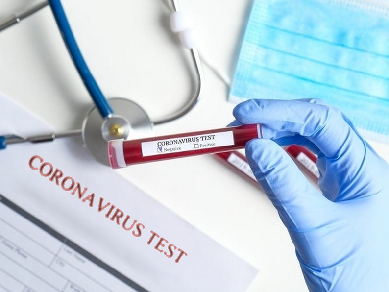الشبكة المغربية للدفاع عن الحق في الصحة والحق في الحياة تحذر من نتائج اختبارات كورونا السلبية ”الخاطئة” #كوفيد_19